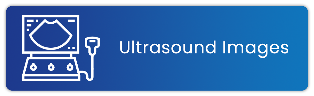 vs23 buttons ultrasound images
